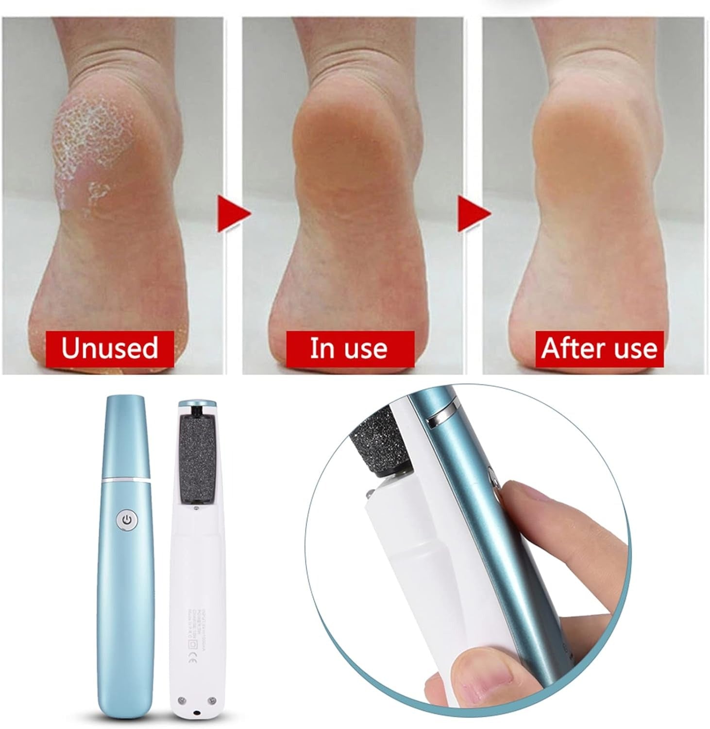 SoftStep Eeltverwijderaar