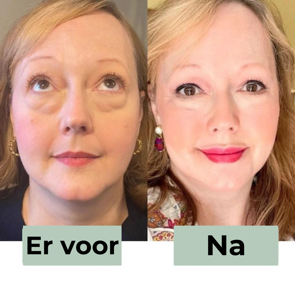 CËLYN LineaLift Oogcrème