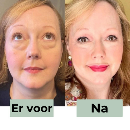 CËLYN LineaLift Oogcrème