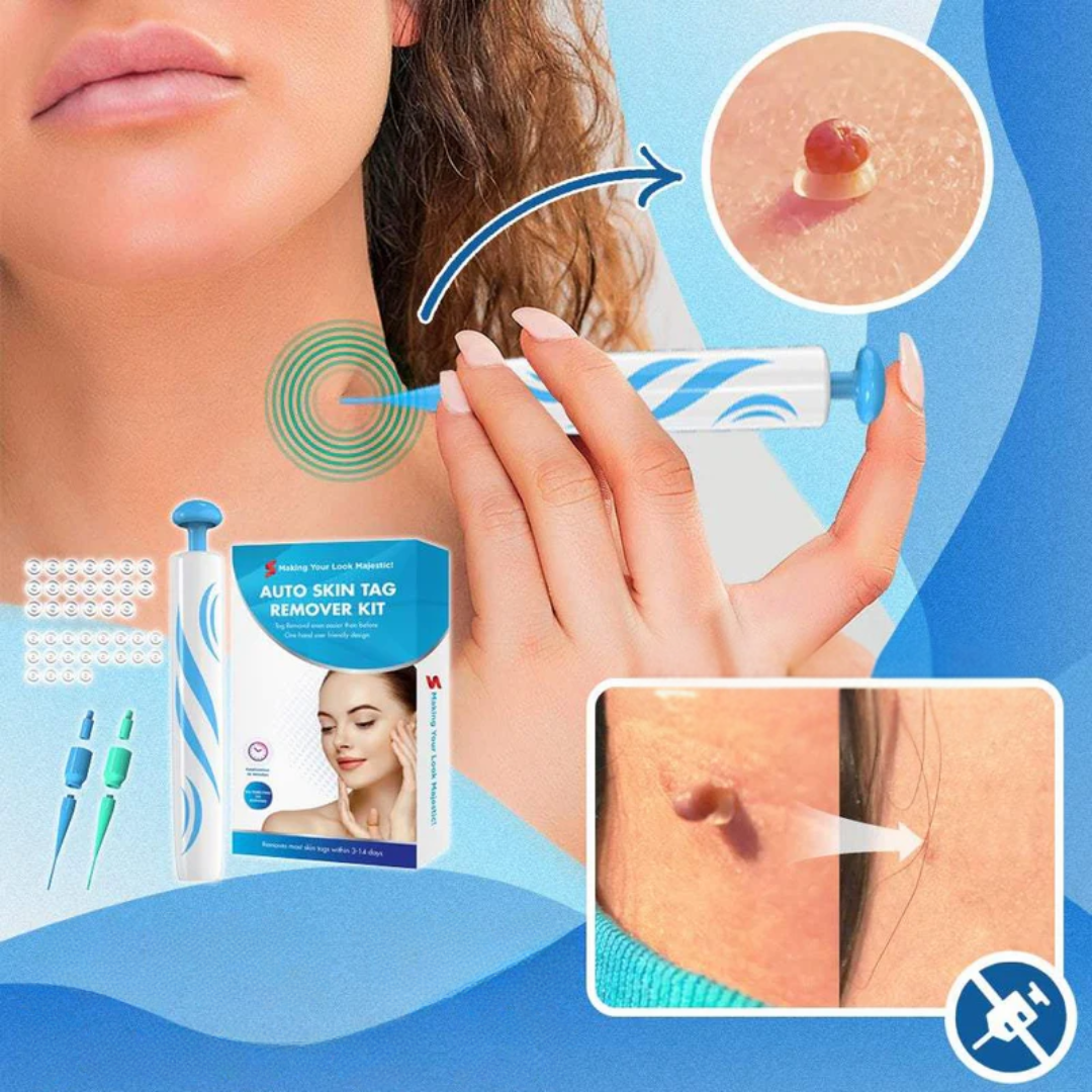 DermaTag Verwijderingsset
