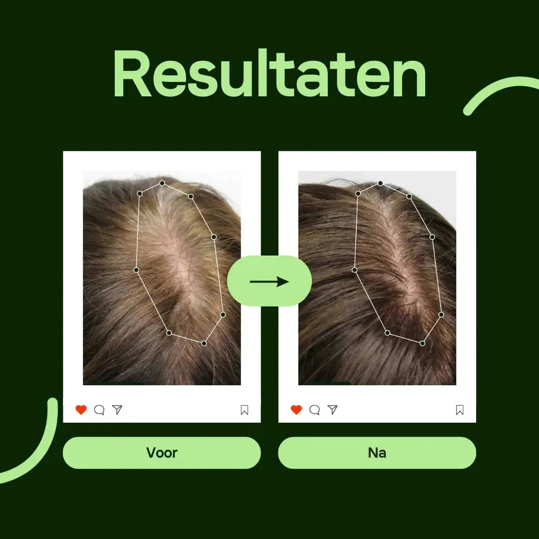 HairVital Pro Serum