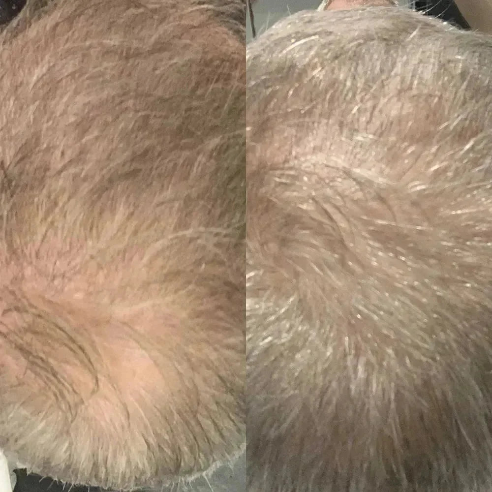 HairVital Pro Serum