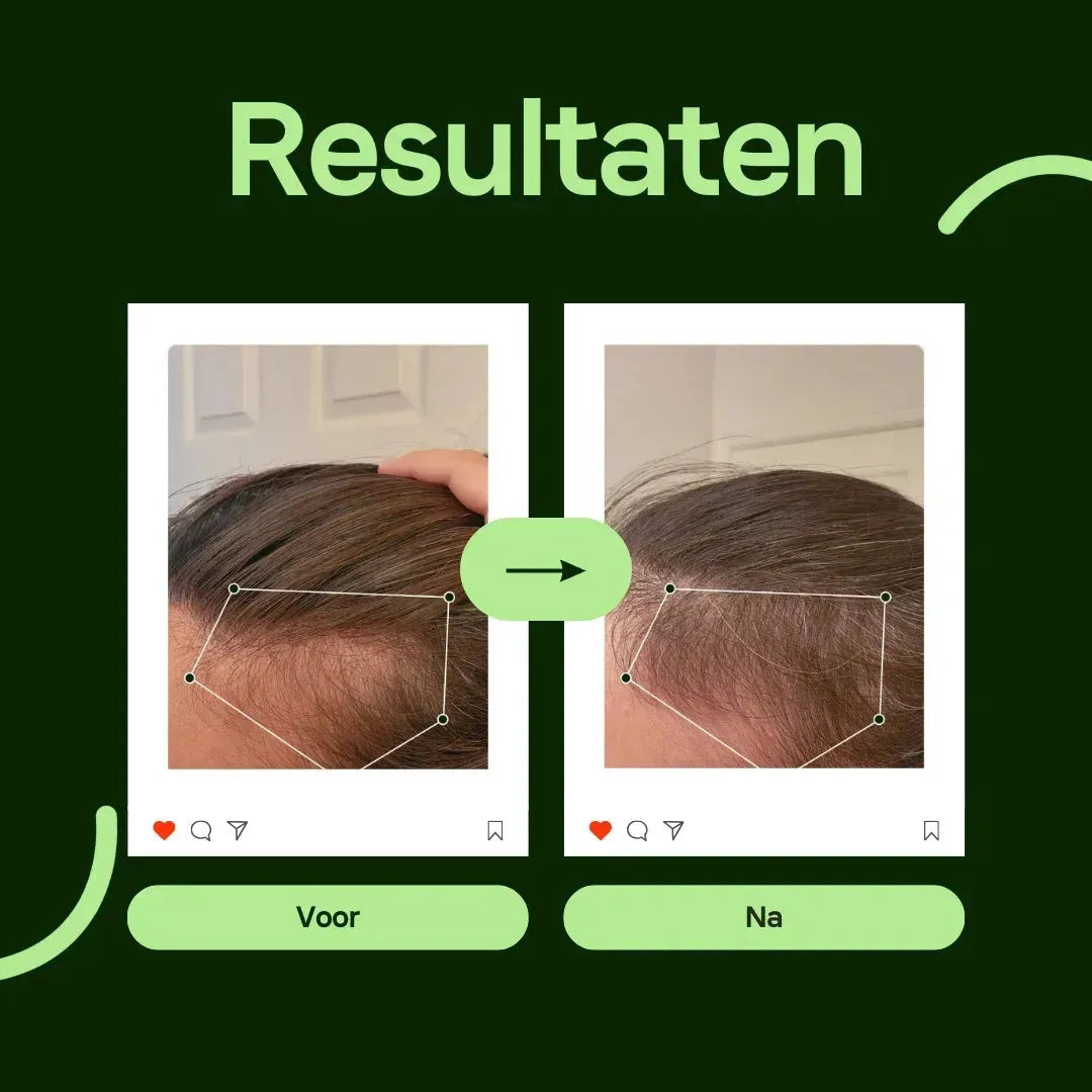 HairVital Pro Serum